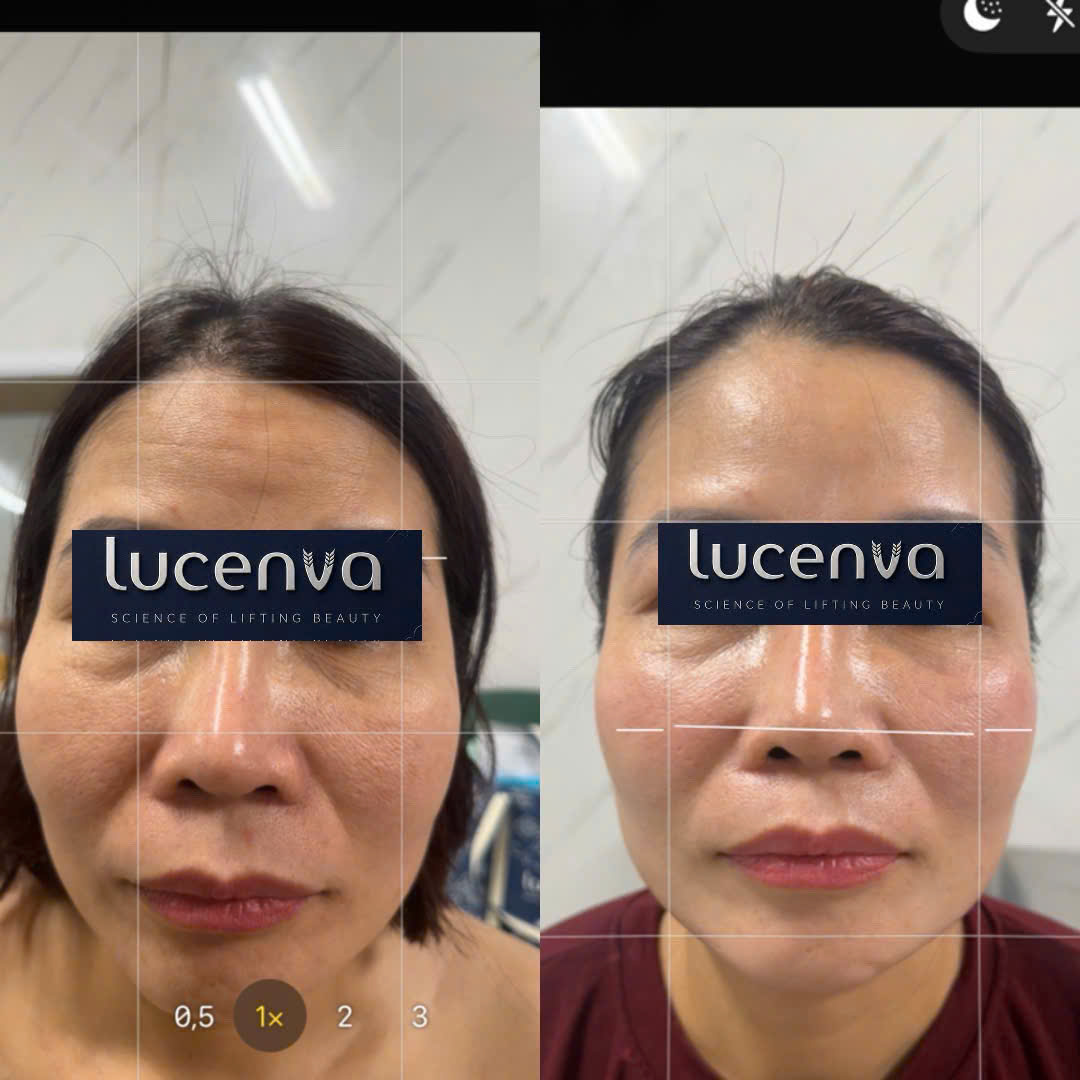 Khách hàng Lucenva 3