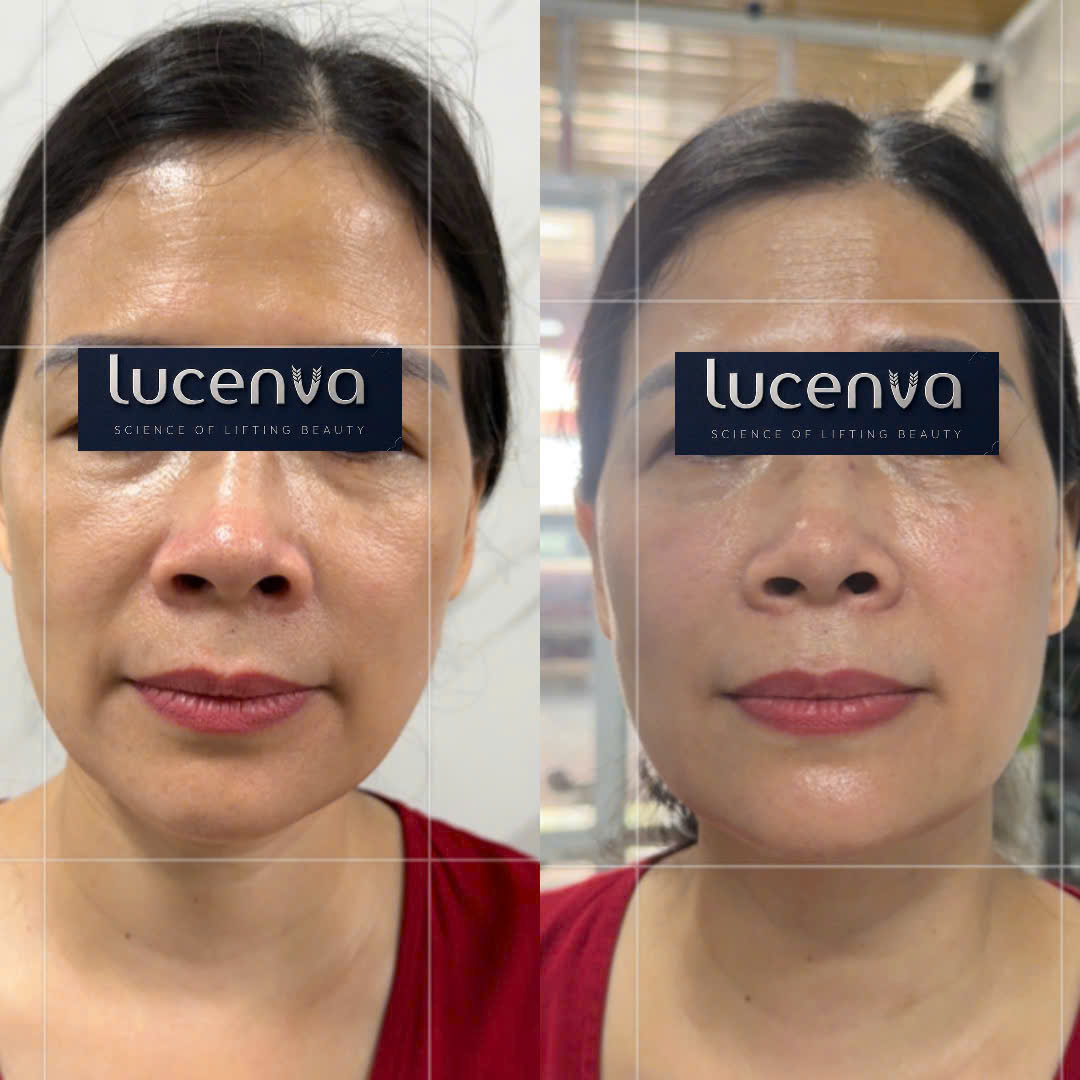 Khách hàng Lucenva 4
